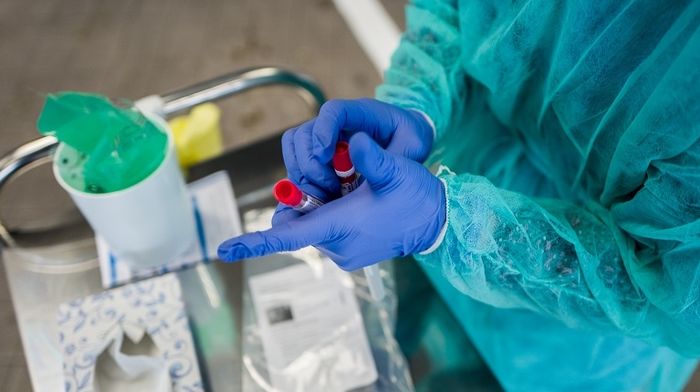 ARRÊT DE LA PERMANENCE TEST COVID-19